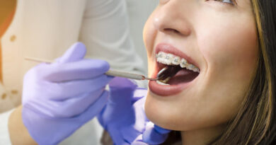 Which Cosmetic Dental Procedures Are Often Combined?