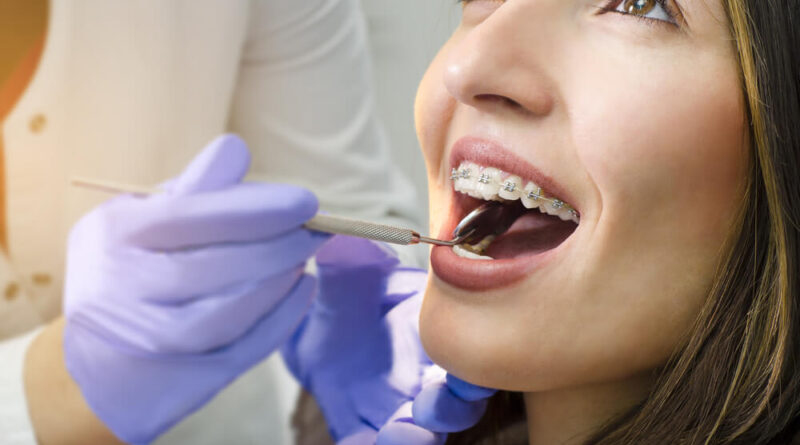 Which Cosmetic Dental Procedures Are Often Combined?