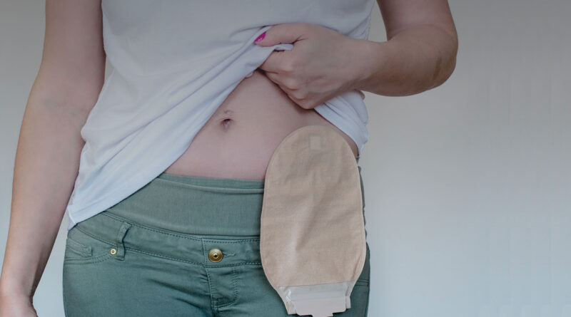 How to Maintain Ostomy Bag leakage: Tips and Tricks