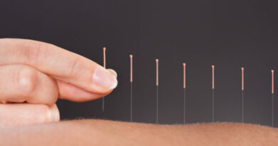 What Does Acupuncture Actually Do?