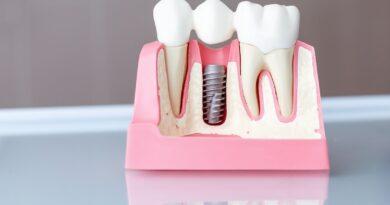 Pure Smiles - Dental Implants: what you need to know